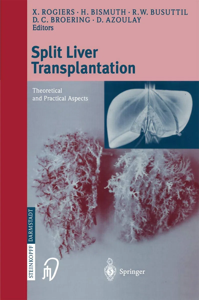 Split Liver transplantation: Theoretical and practical aspects