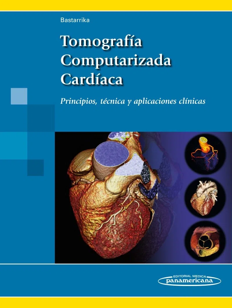 Tomografía Computarizada Cardíaca. Principios, técnica y aplicaciones clínicas
